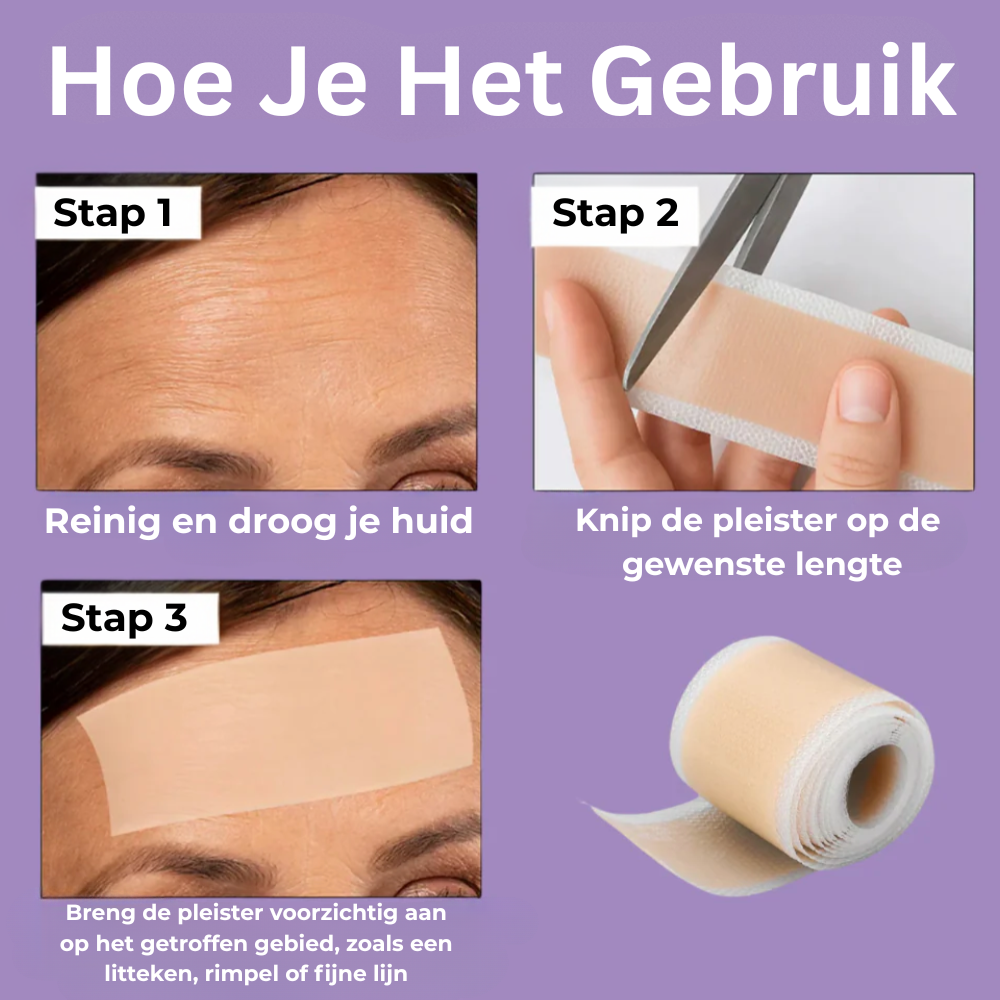 NovaSkin - Siliconenpleisters tegen littekens en rimpels
