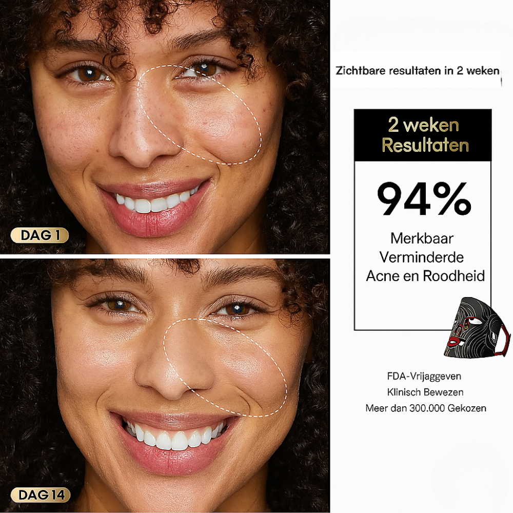 LUMERA Wireless Red Light Mask