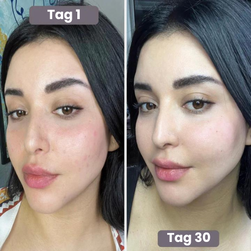 Mayfina's Anti Aging Therapie