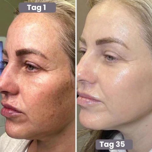 Mayfina's Anti Aging Therapie