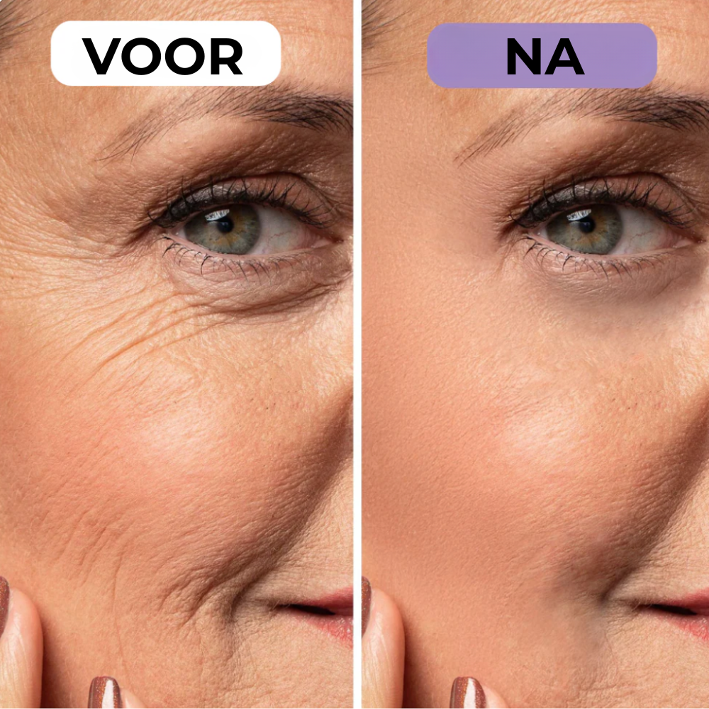 NovaSkin - Siliconenpleisters tegen littekens en rimpels