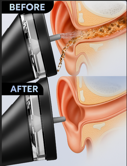 EarFlow Pro The Safe, Natural Way to Clean Ears