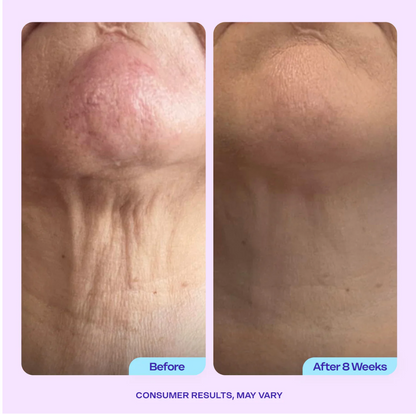 Bloom Nekverjongende Crème